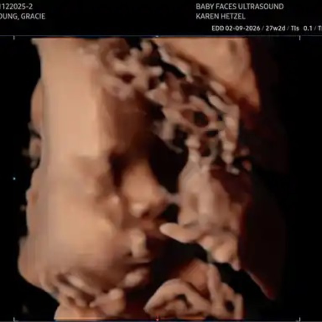 Photo shared by Gracie Leigh for their Babylist baby registry.