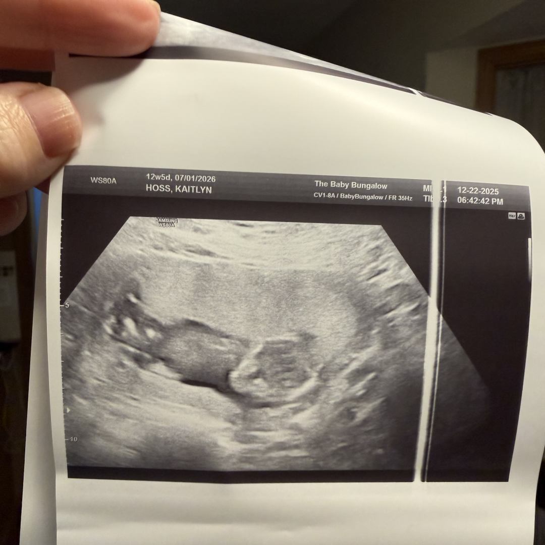 Photo shared by Kate&Dan for their Babylist baby registry.