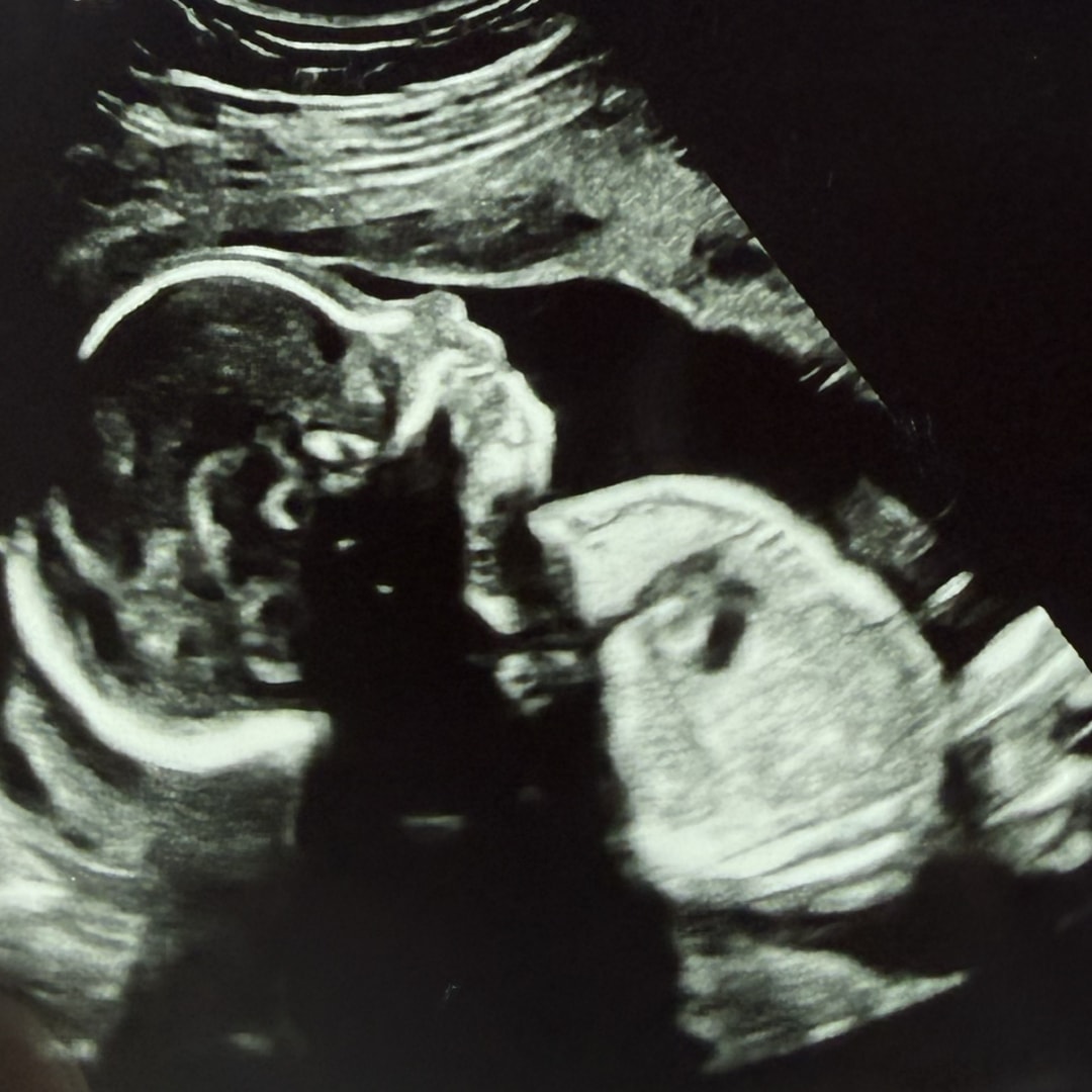 Photo shared by Nicole for their Babylist baby registry.