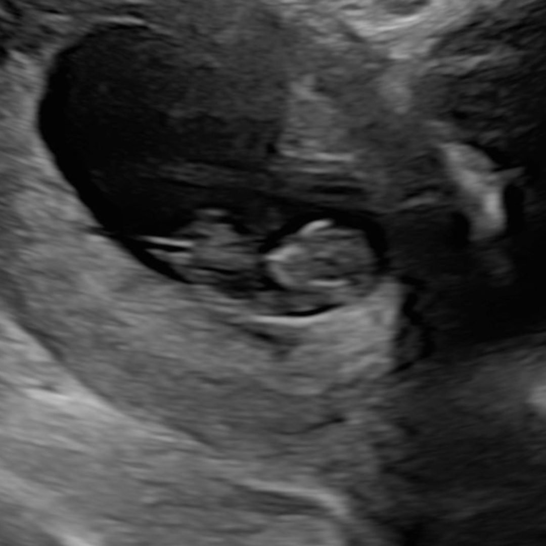 Photo shared by Charles for their Babylist baby registry.