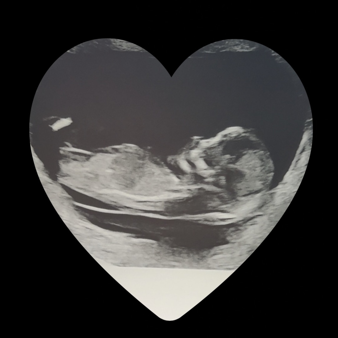 Photo shared by Samantha for their Babylist baby registry.