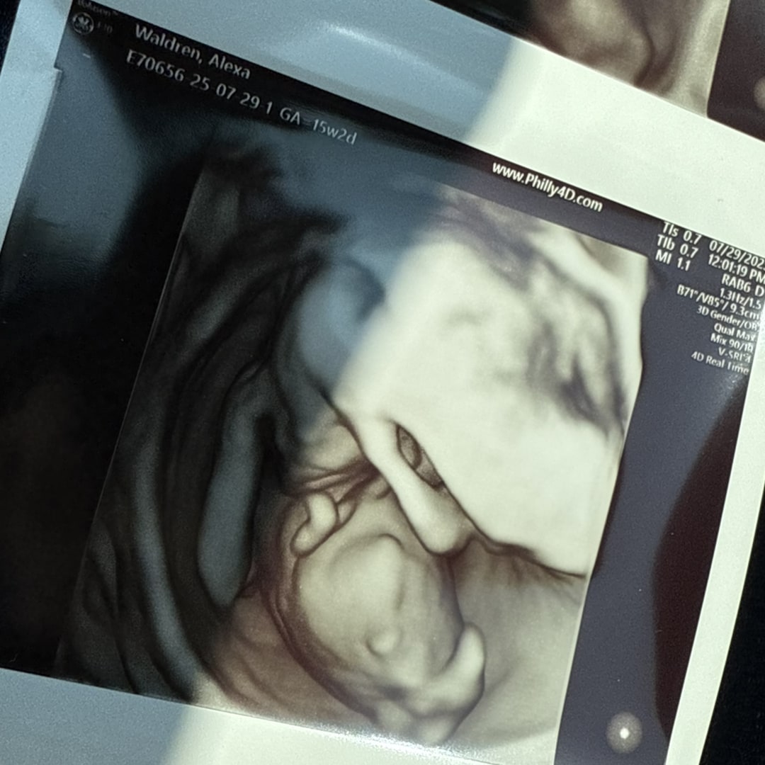 Photo shared by Alexa for their Babylist baby registry.