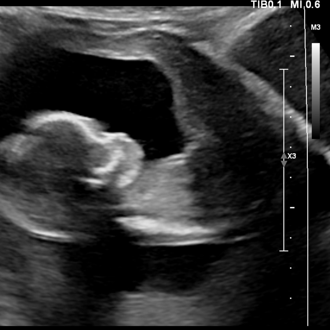 Photo shared by Jalyn for their Babylist baby registry.