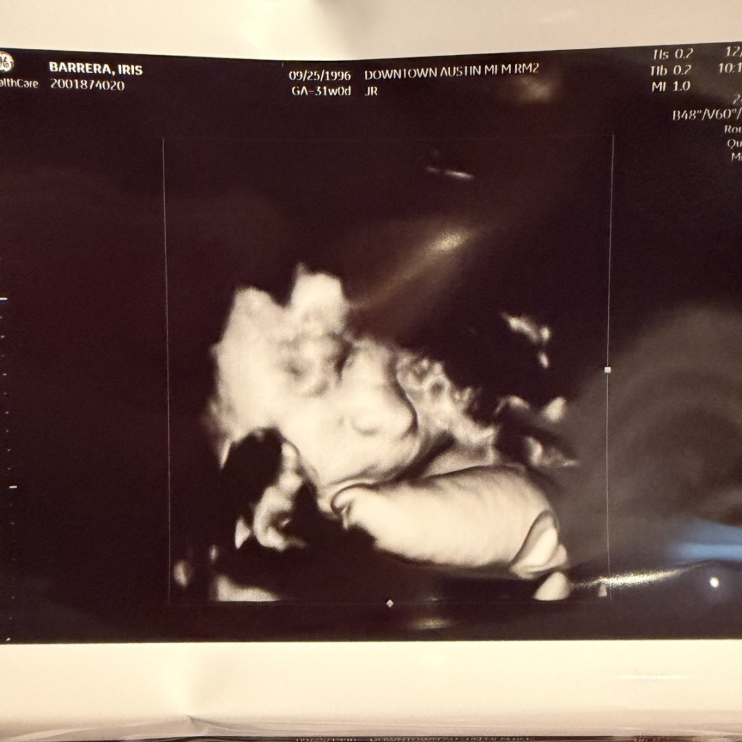 Photo shared by Iris for their Babylist baby registry.