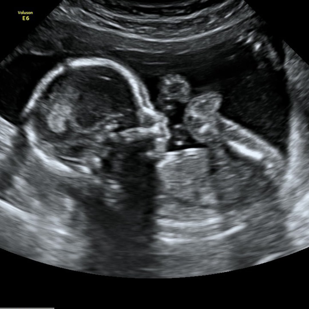 Photo shared by Sarah for their Babylist baby registry.