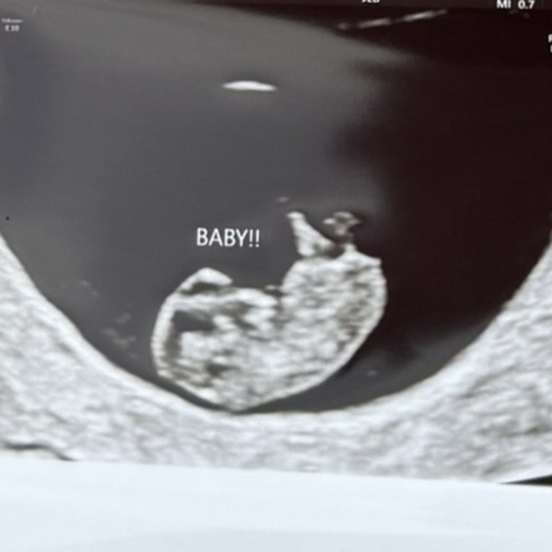 Photo shared by Ariel for their Babylist baby registry.