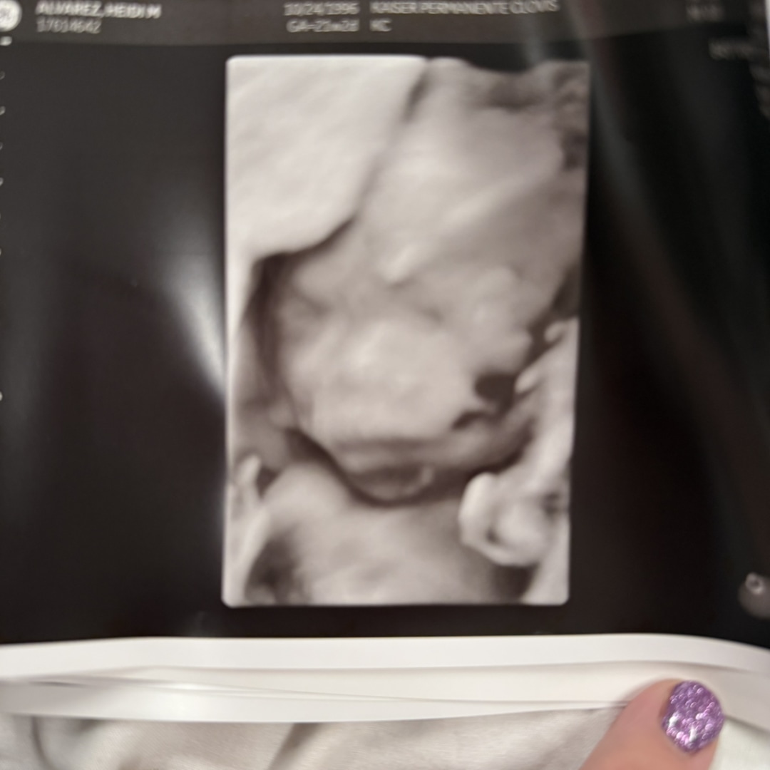 Photo shared by Heidi for their Babylist baby registry.