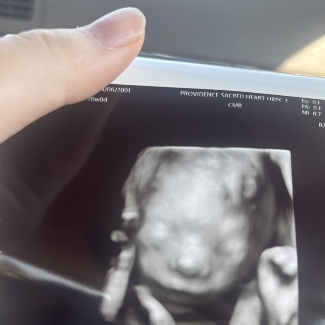 Photo shared by Olivia for their Babylist baby registry.