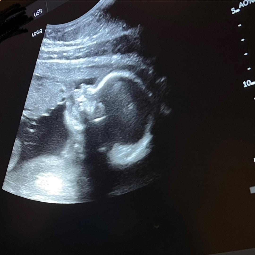 Photo shared by Daisy for their Babylist baby registry.