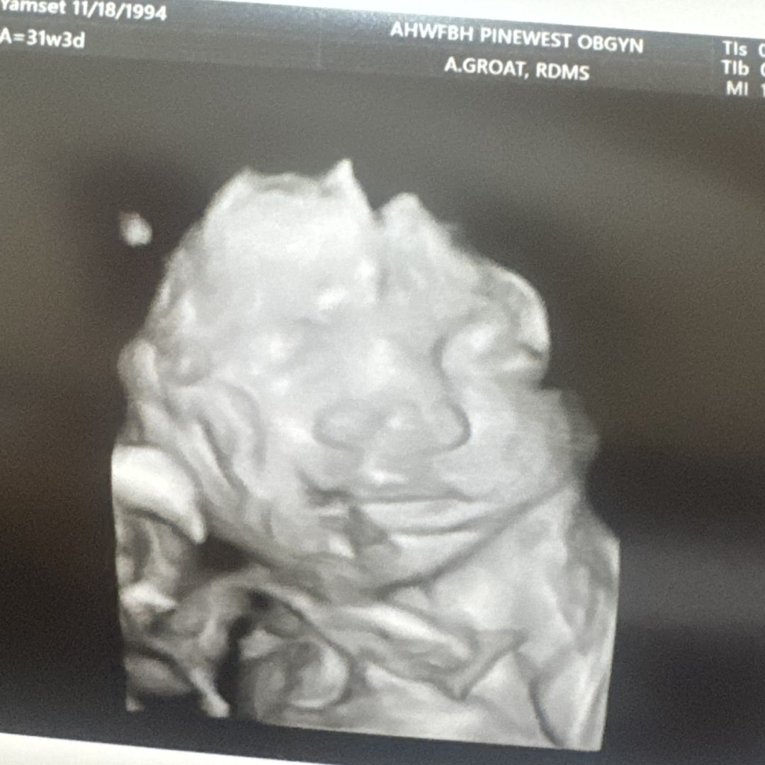 Photo shared by Leslie for their Babylist baby registry.