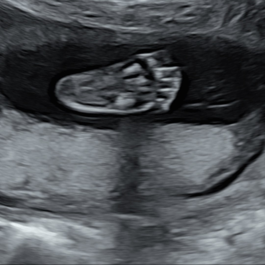 Photo shared by Megan for their Babylist baby registry.