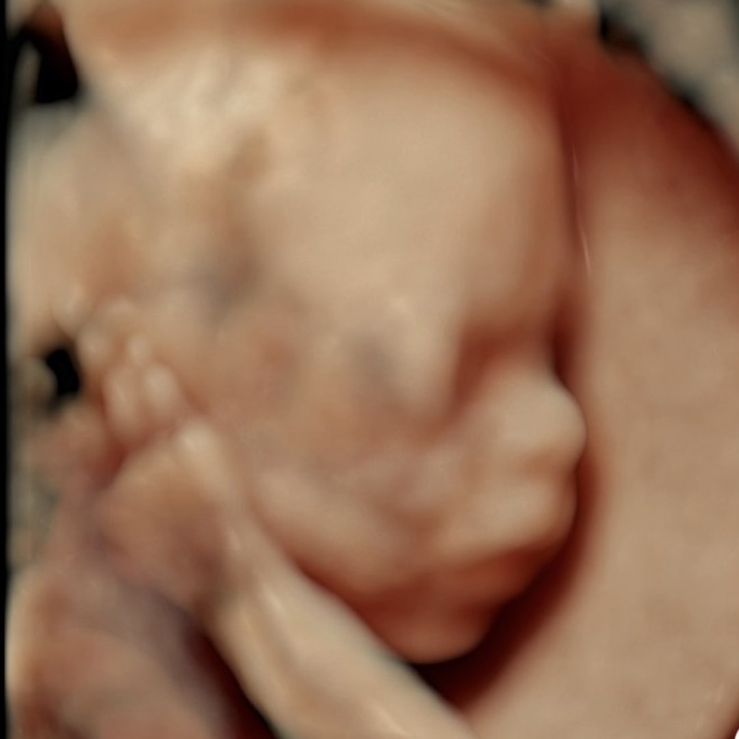 Photo shared by Reese for their Babylist baby registry.