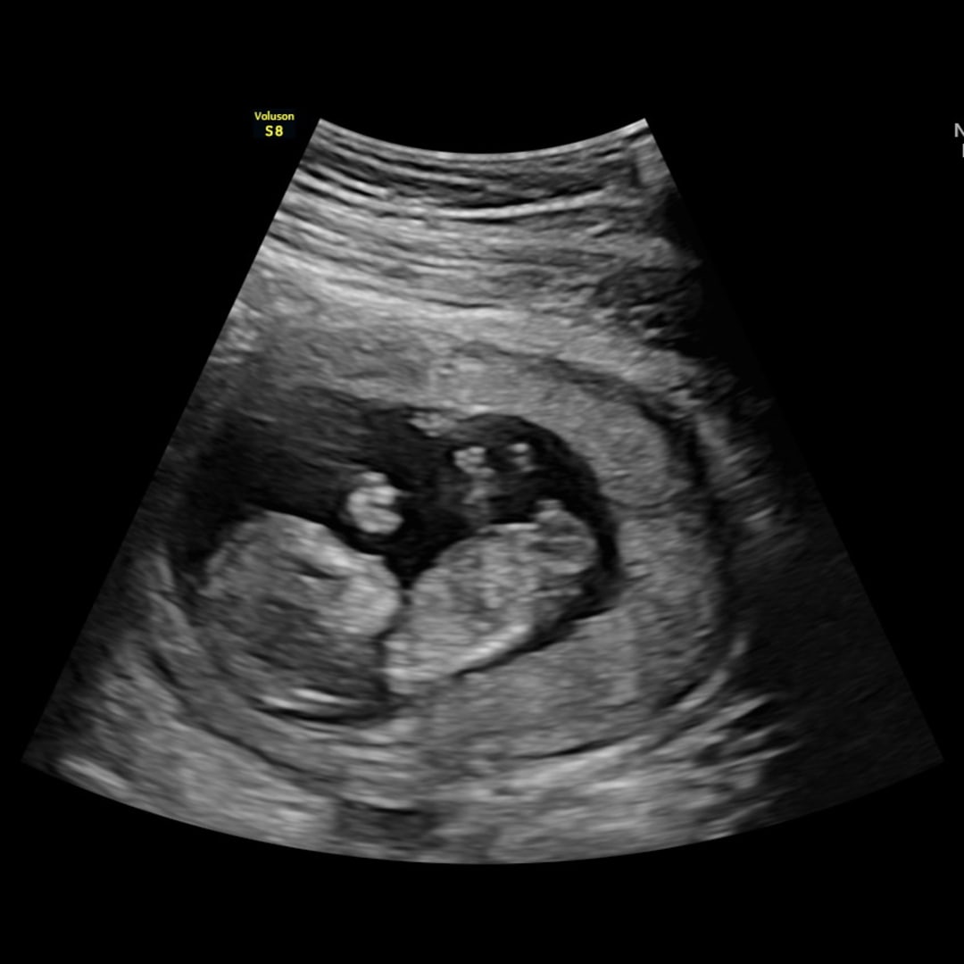 Photo shared by Jaden for their Babylist baby registry.