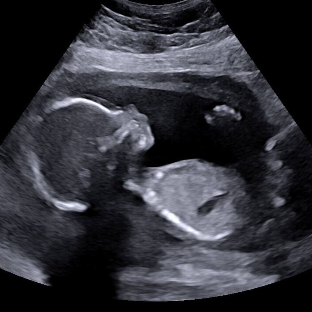 Photo shared by Jolie for their Babylist baby registry.