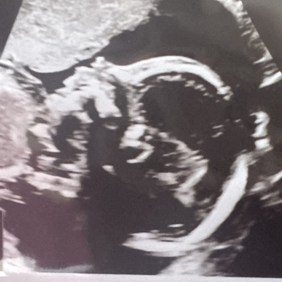 Photo shared by Rebekah for their Babylist baby registry.