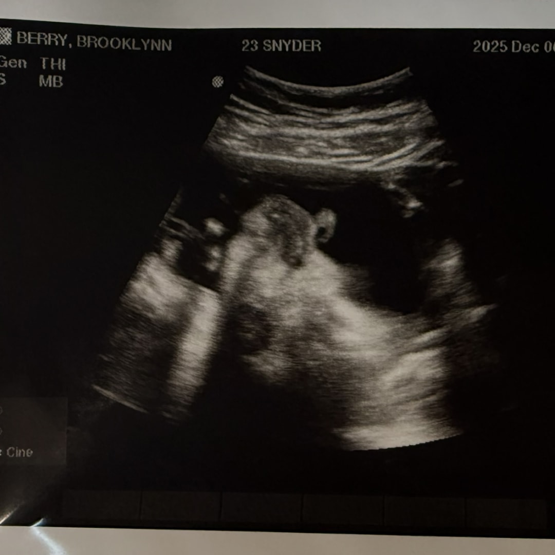 Photo shared by Brooklynn for their Babylist baby registry.