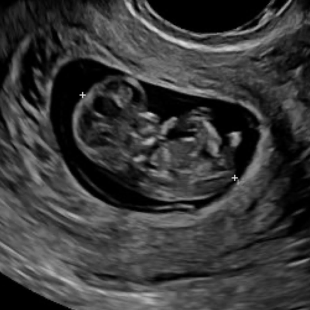 Photo shared by Azul for their Babylist baby registry.