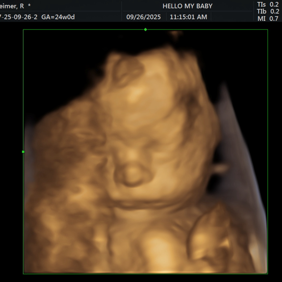 Photo shared by Rebecca for their Babylist baby registry.