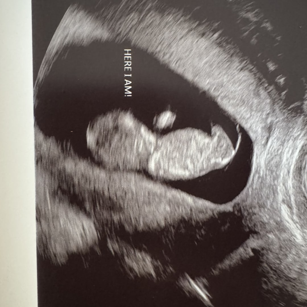 Photo shared by Maggee for their Babylist baby registry.