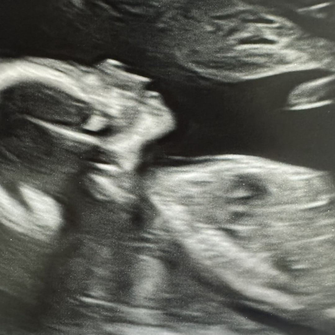 Photo shared by Landre for their Babylist baby registry.