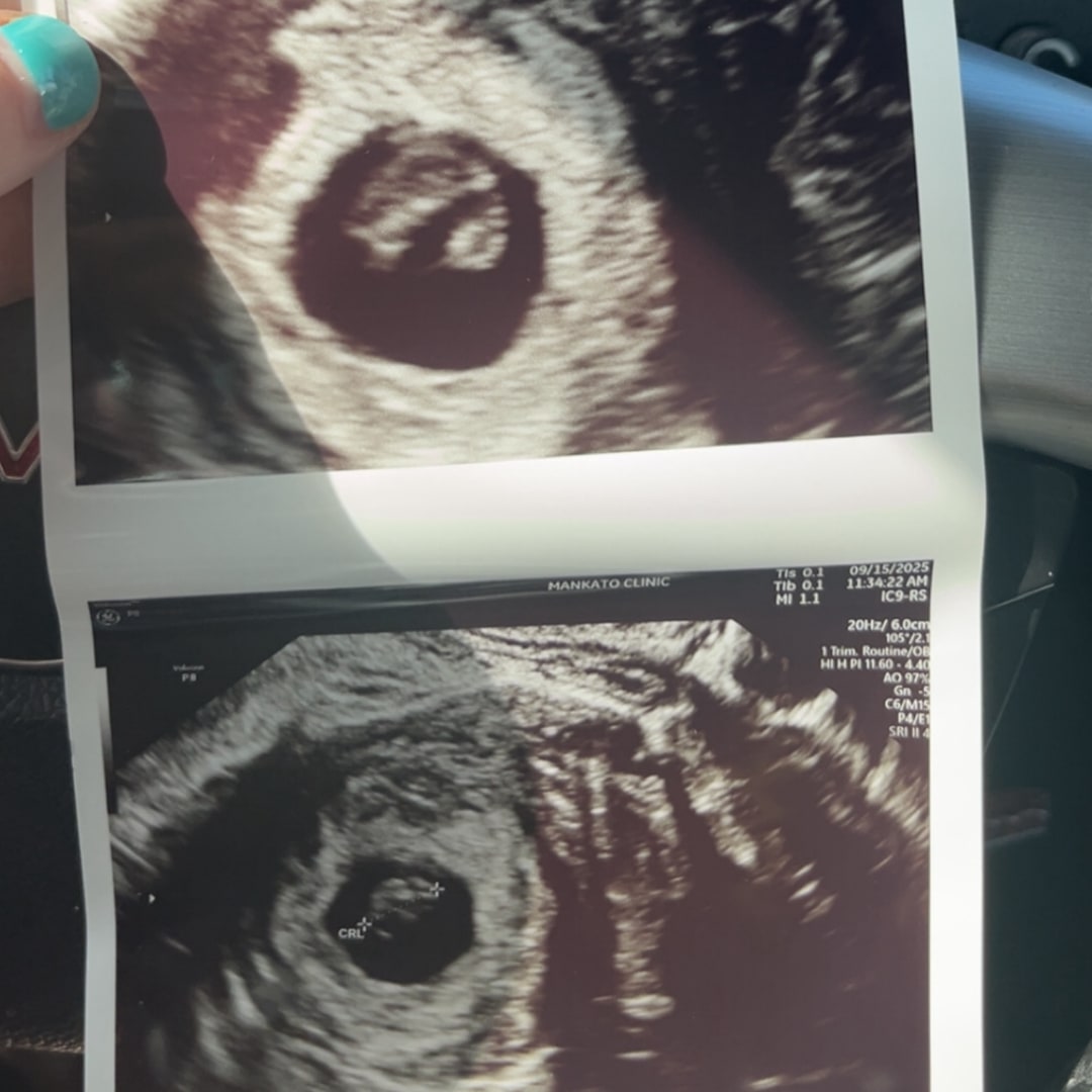 Photo shared by Ellie for their Babylist baby registry.