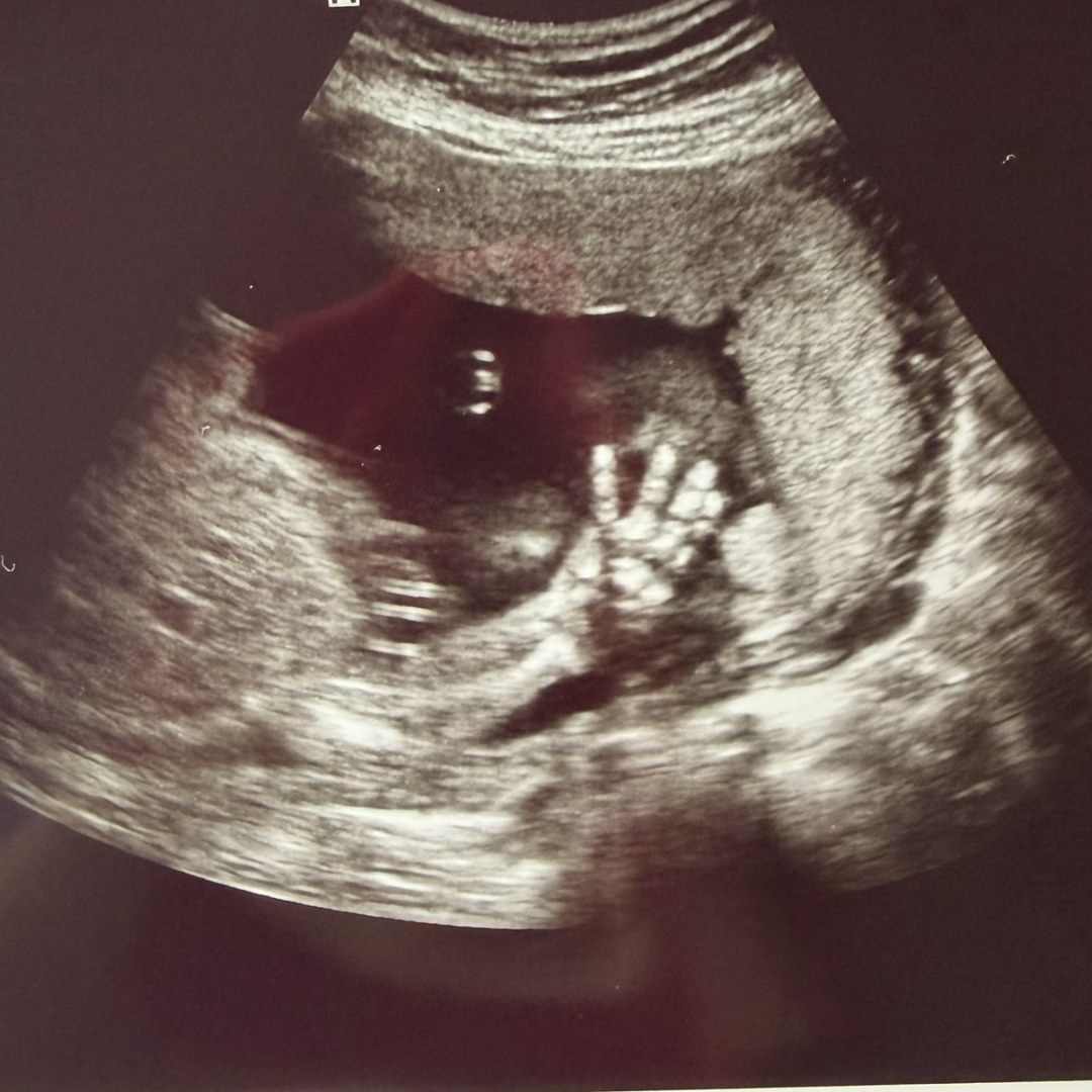 Photo shared by Jenn for their Babylist baby registry.