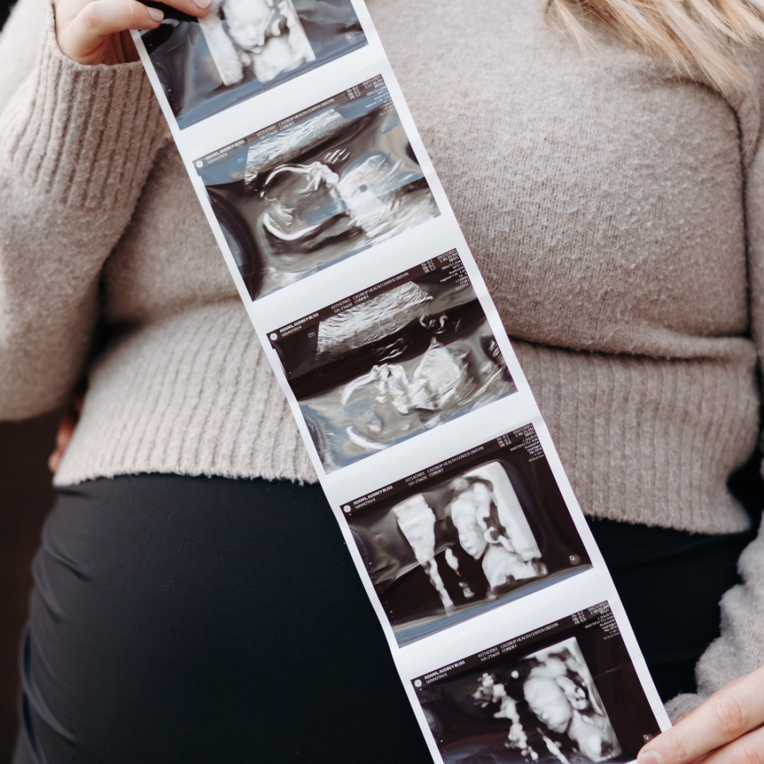 Photo shared by Audrey for their Babylist baby registry.