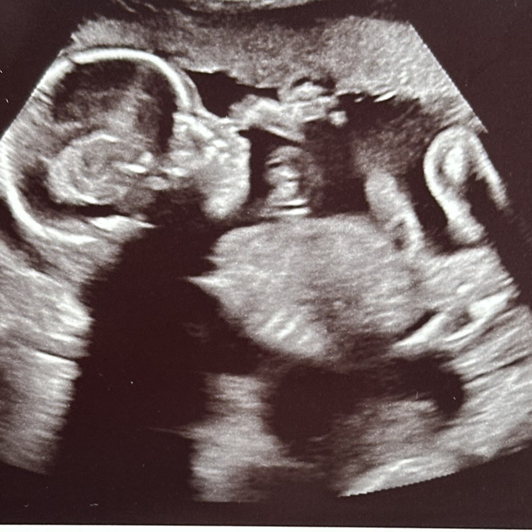 Photo shared by Teri for their Babylist baby registry.