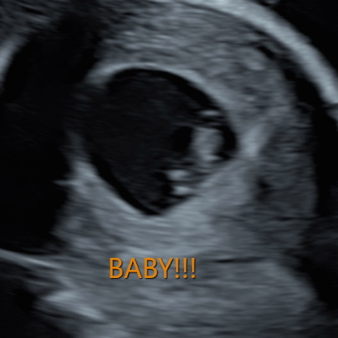 Photo shared by Isabella for their Babylist baby registry.