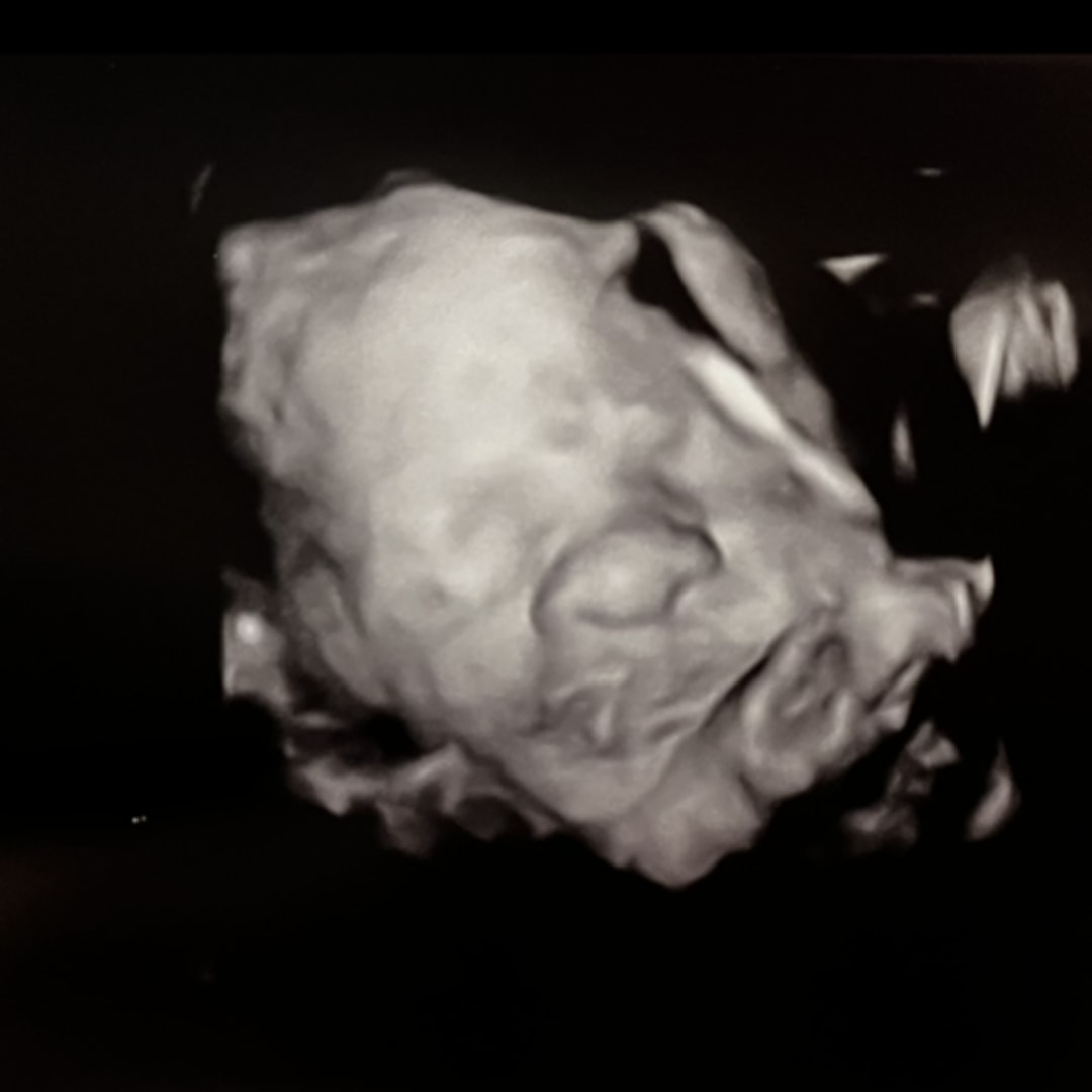 Photo shared by Lexi for their Babylist baby registry.