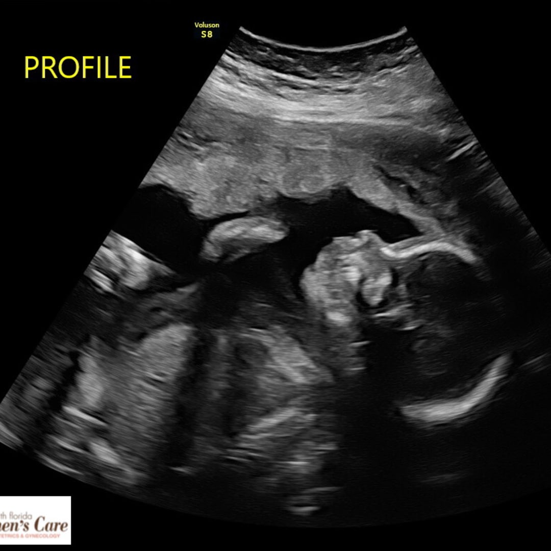 Photo shared by Allison for their Babylist baby registry.