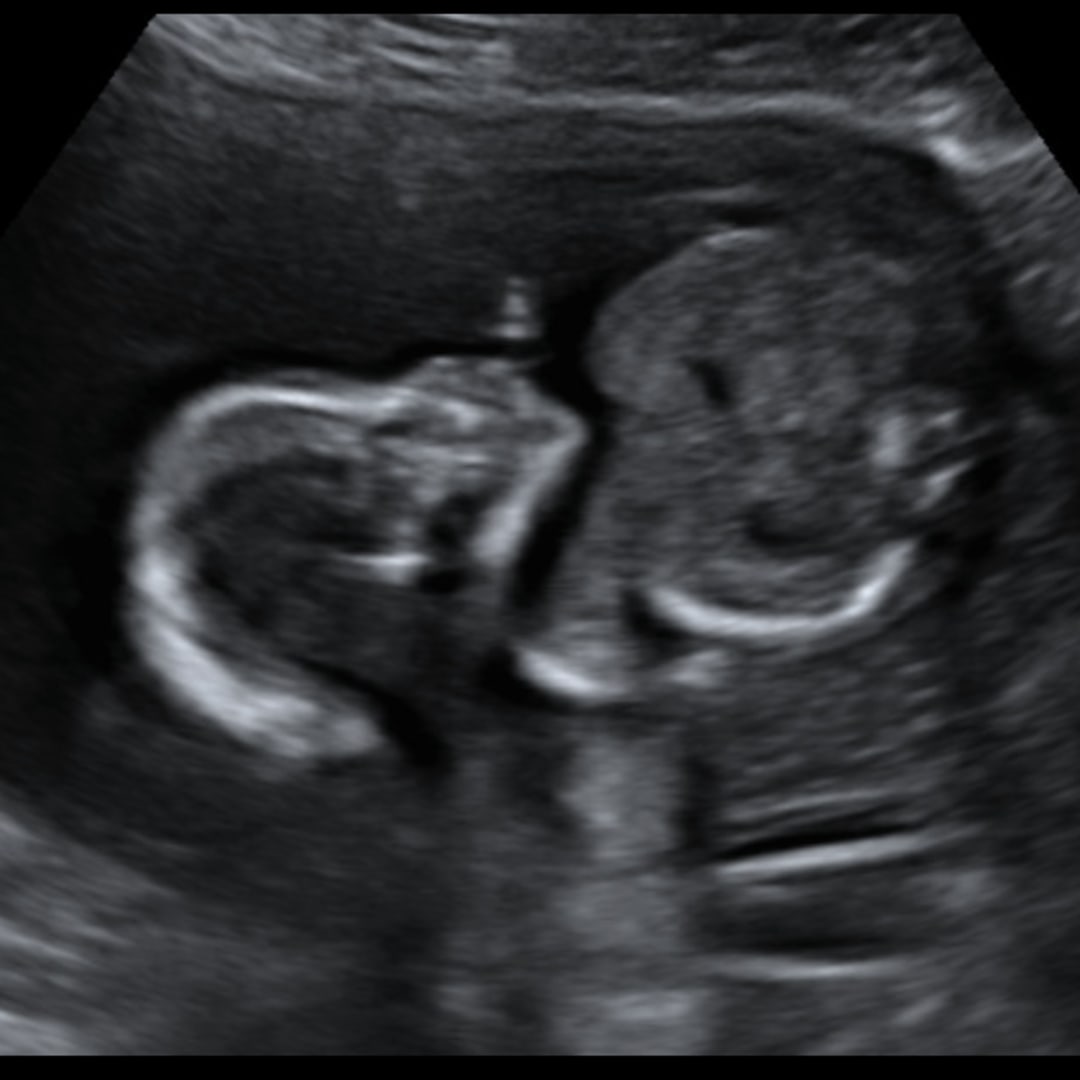 Photo shared by Haley for their Babylist baby registry.