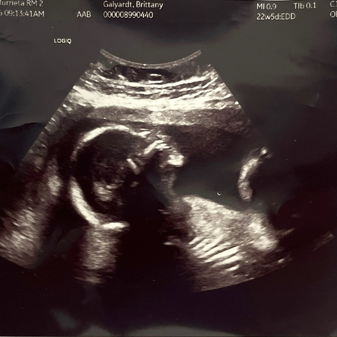 Photo shared by Brittany for their Babylist baby registry.