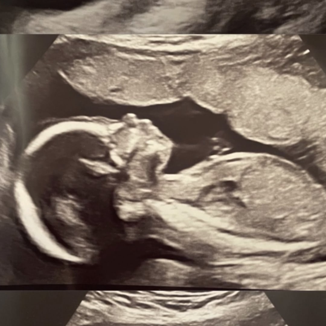 Photo shared by Keila for their Babylist baby registry.