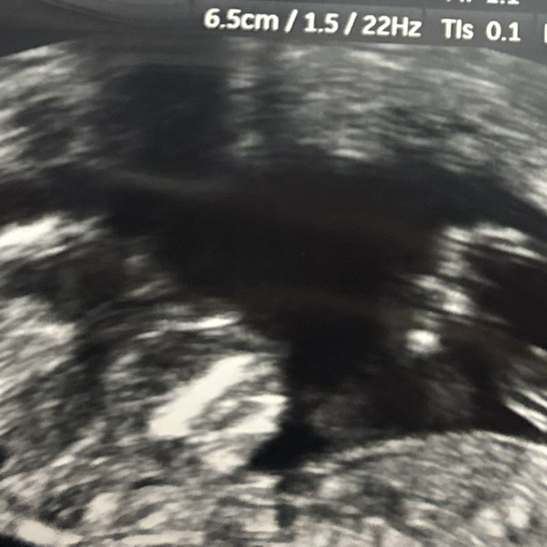 Photo shared by Bee for their Babylist baby registry.