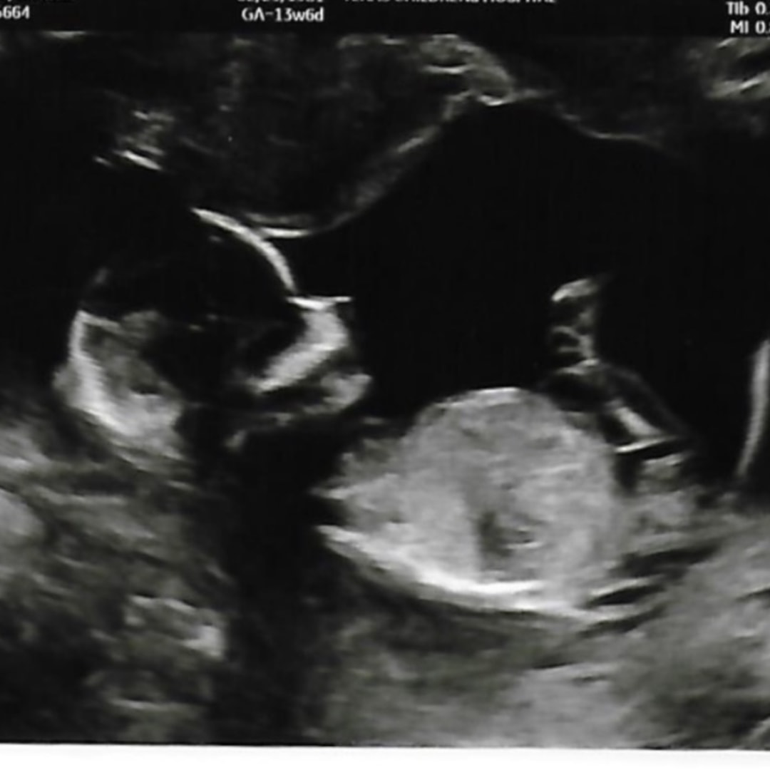 Photo shared by Carrie for their Babylist baby registry.