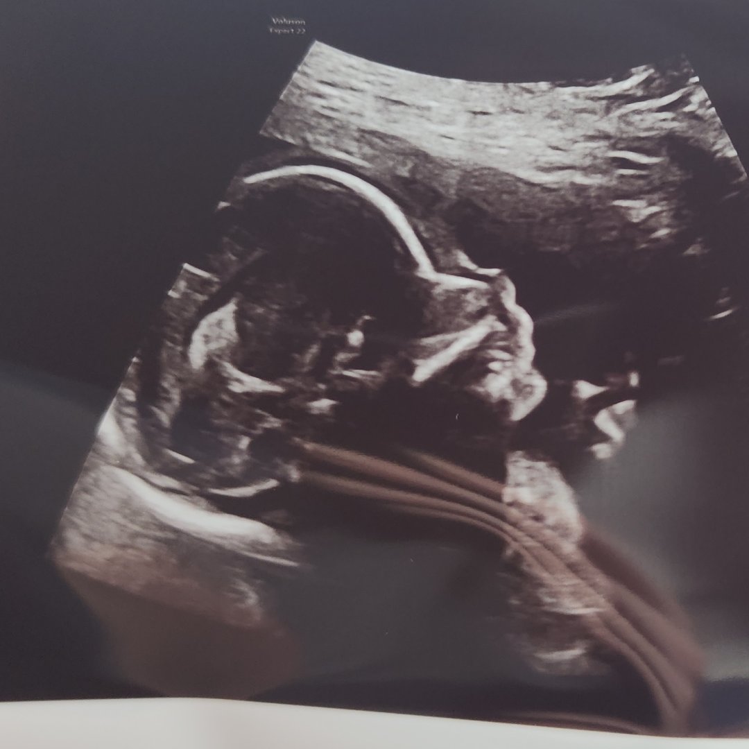 Photo shared by Omar for their Babylist baby registry.