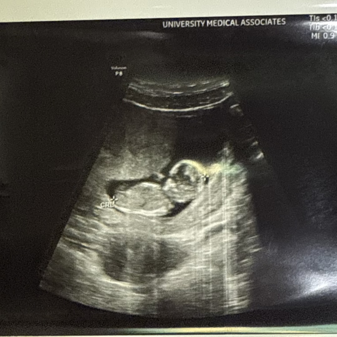 Photo shared by Allison for their Babylist baby registry.