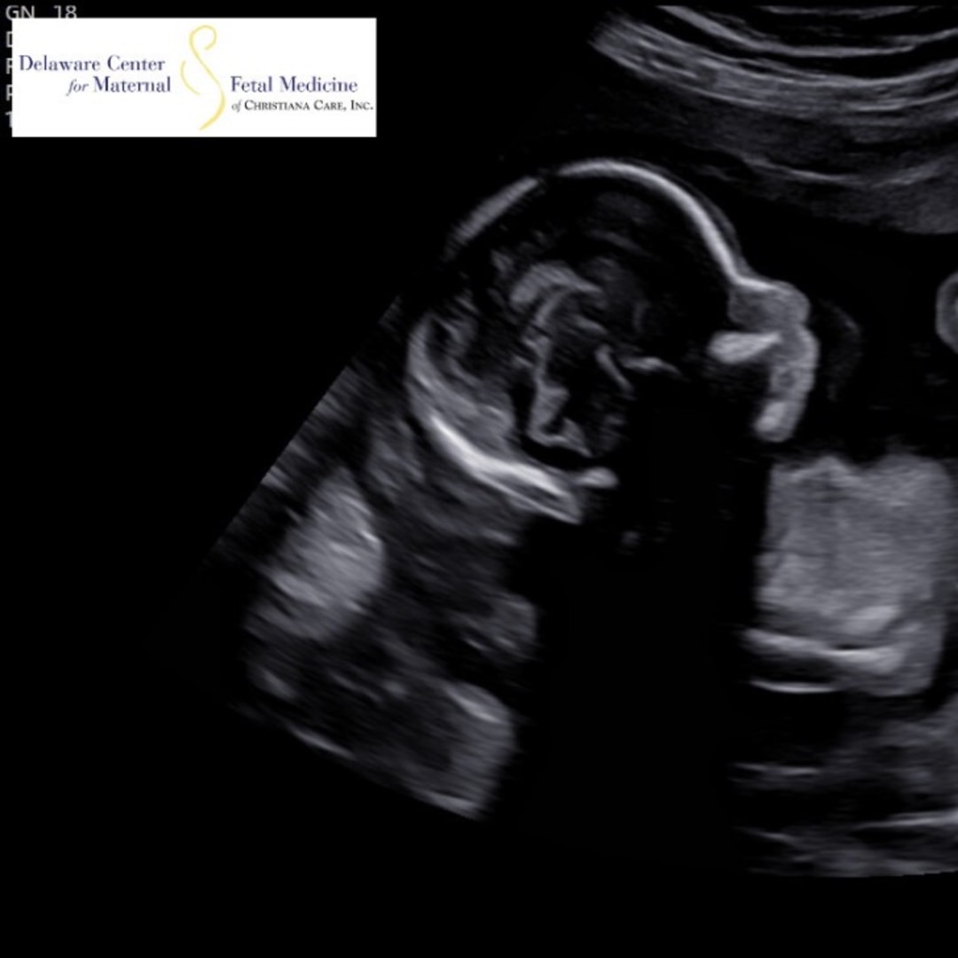 Photo shared by Andrea for their Babylist baby registry.
