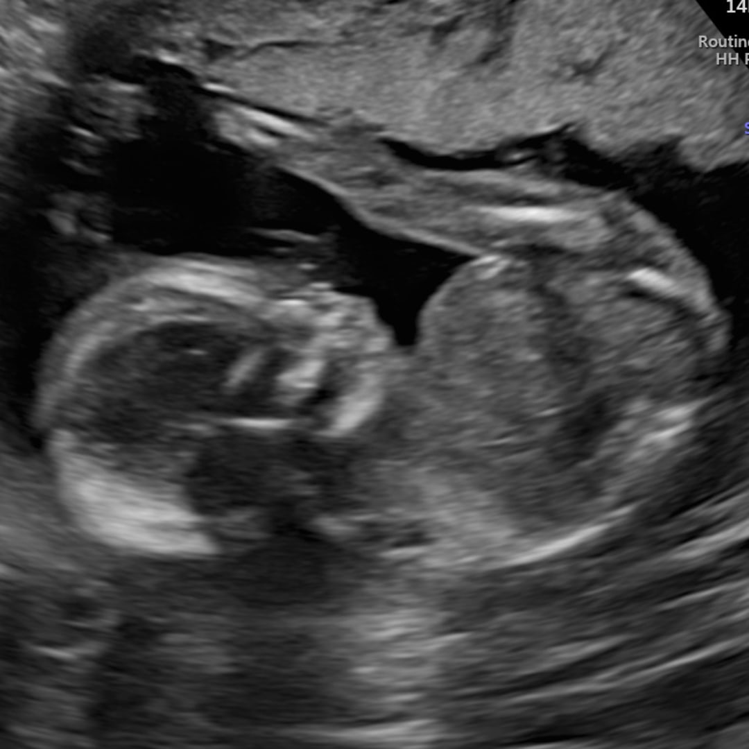 Photo shared by Christa for their Babylist baby registry.