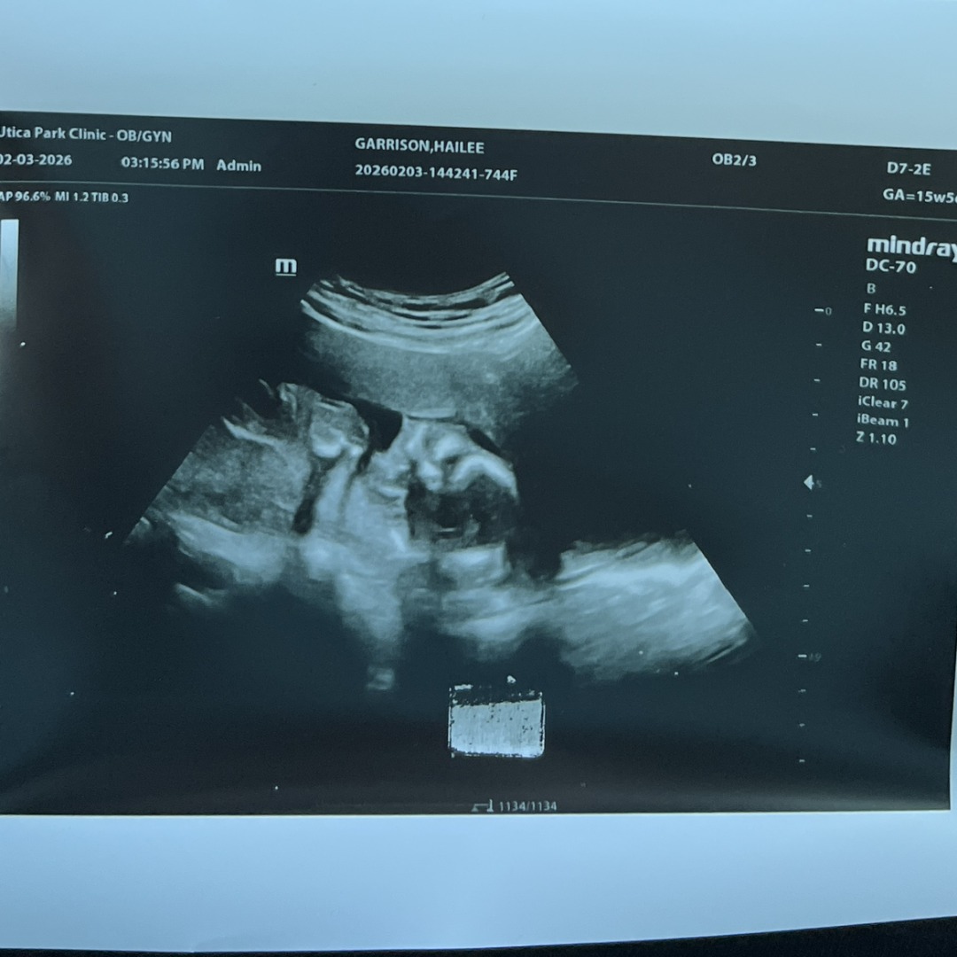 Photo shared by Hailee for their Babylist baby registry.