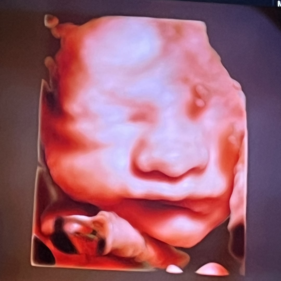 Photo shared by Jessica for their Babylist baby registry.