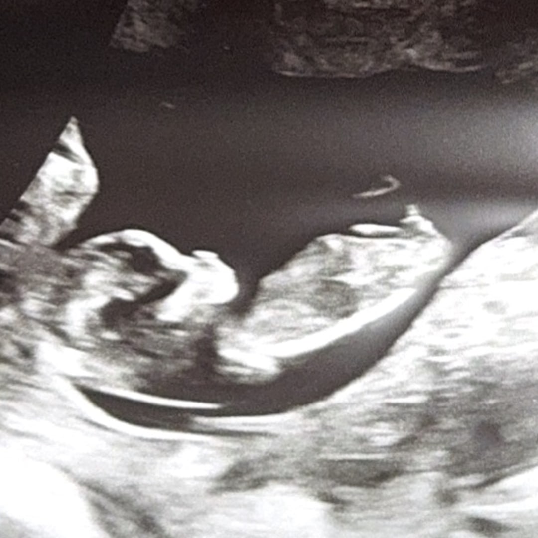Photo shared by Stephanie for their Babylist baby registry.