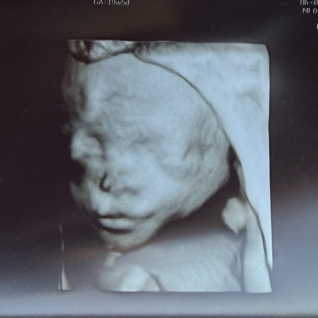 Photo shared by Kaitlyn for their Babylist baby registry.