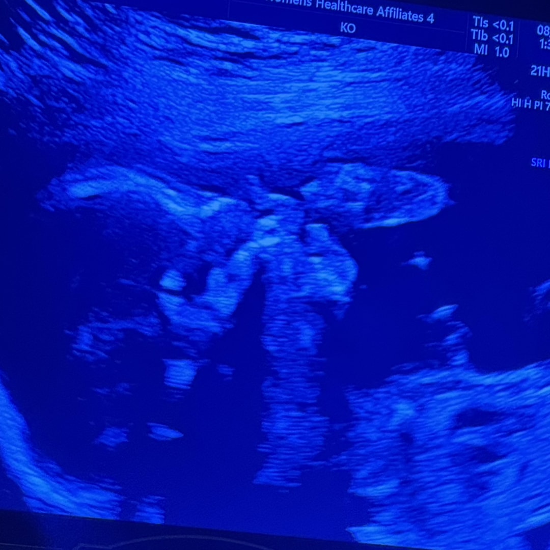 Photo shared by Ashley for their Babylist baby registry.