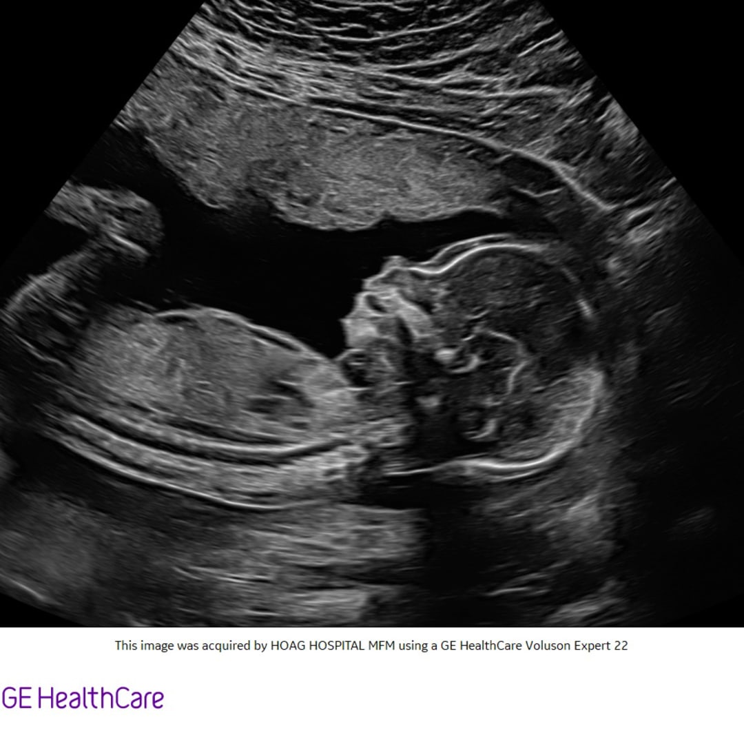 Photo shared by Daisy for their Babylist baby registry.