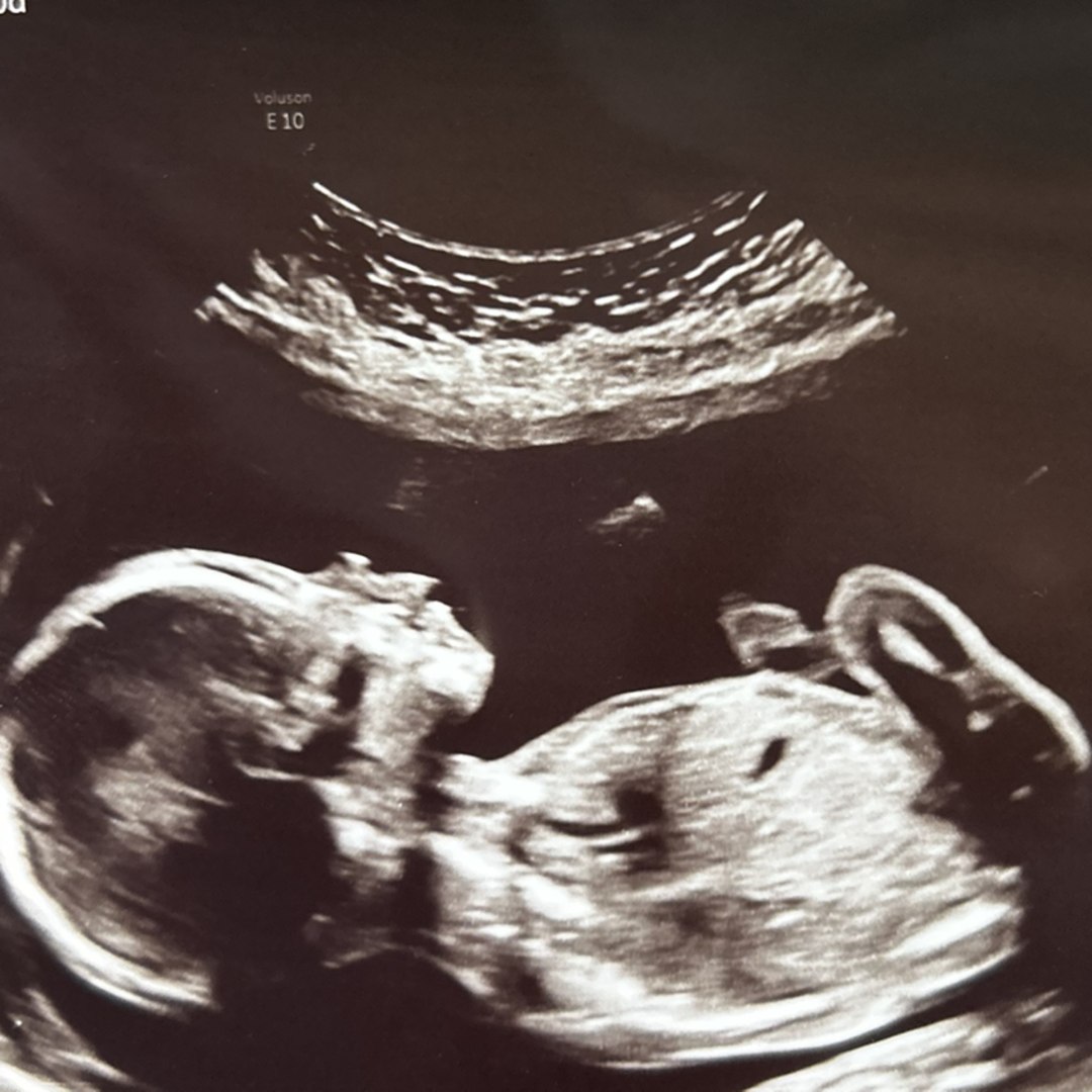 Photo shared by Dolores for their Babylist baby registry.