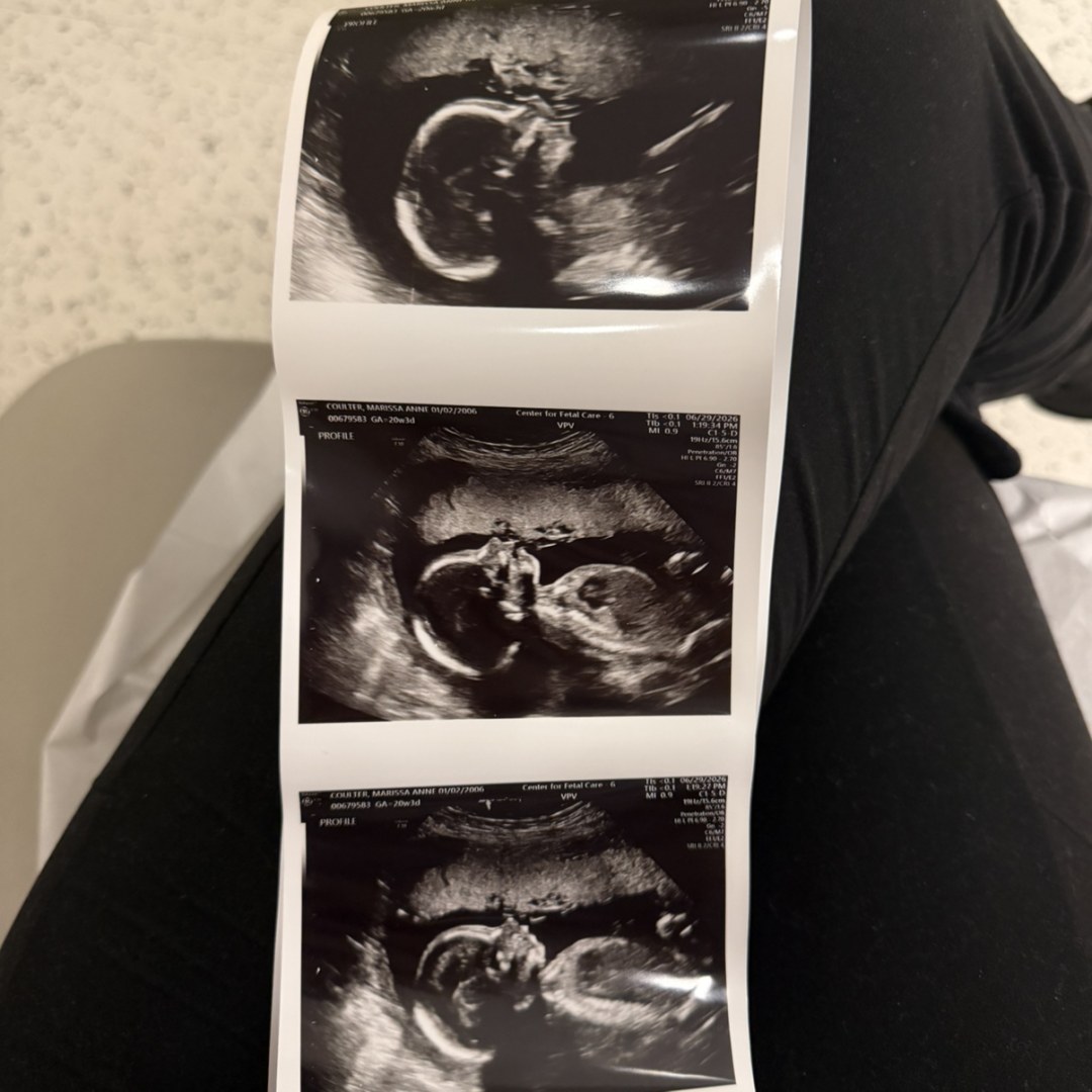 Photo shared by Marissa for their Babylist baby registry.