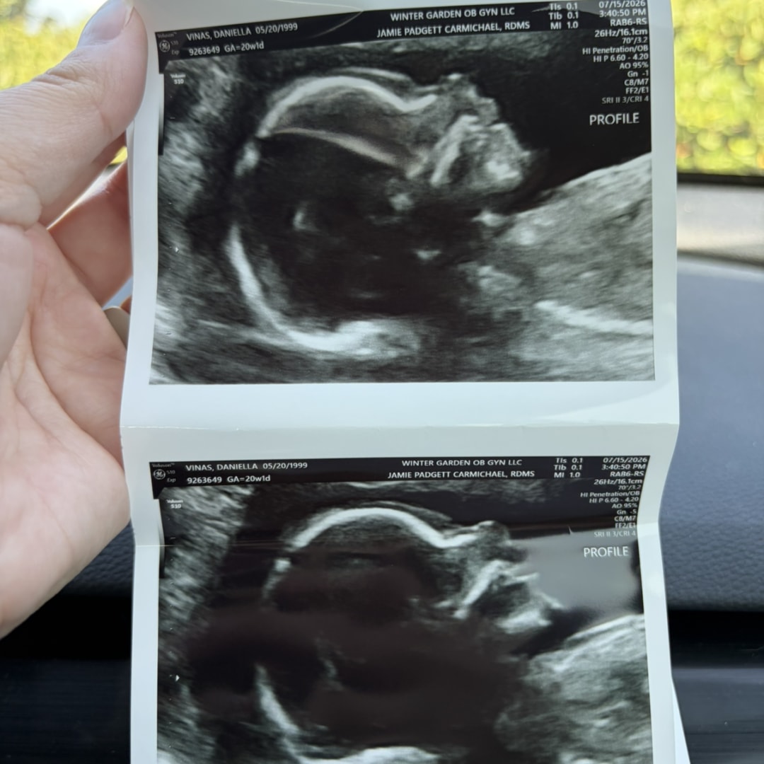 Photo shared by Daniella for their Babylist baby registry.