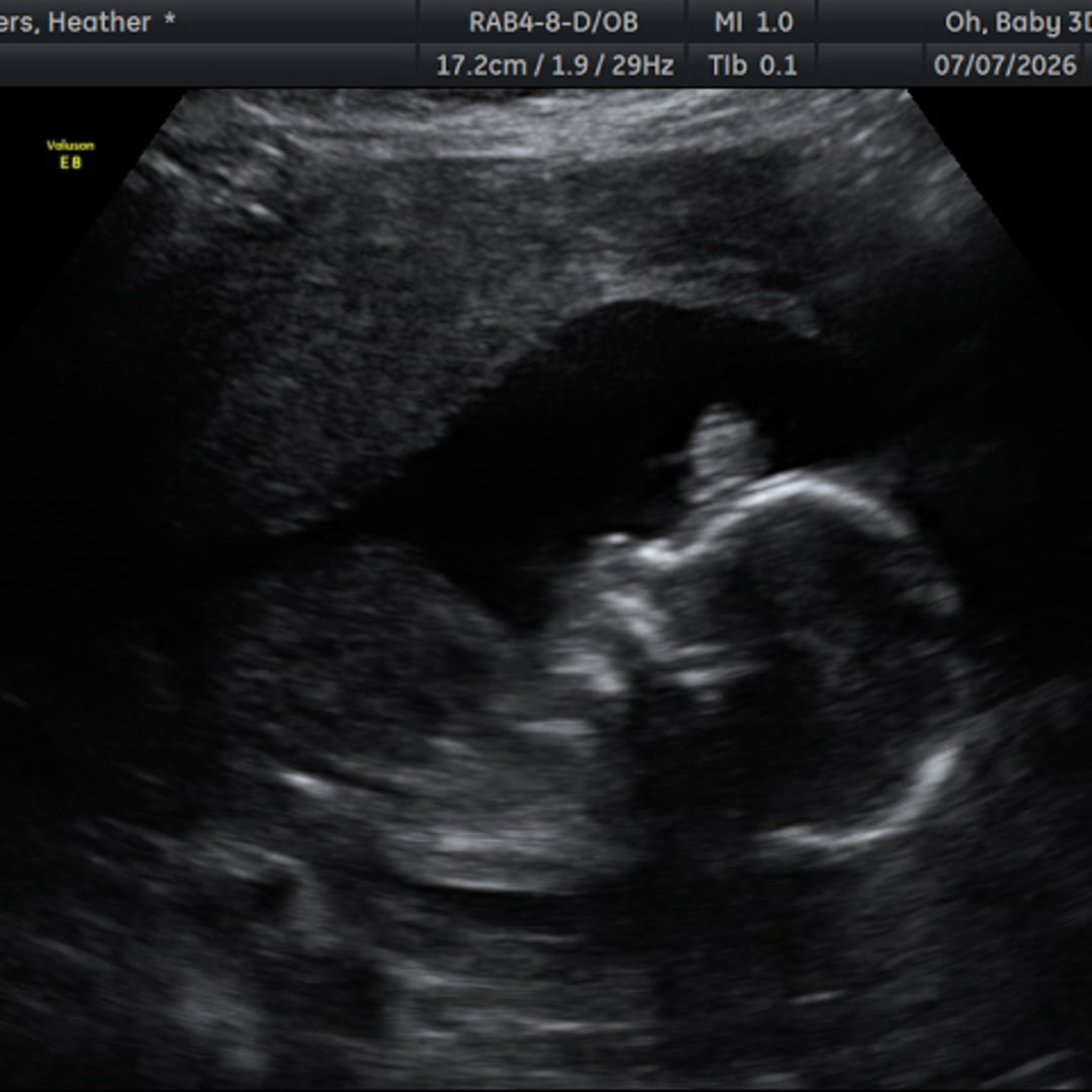 Photo shared by Heather for their Babylist baby registry.